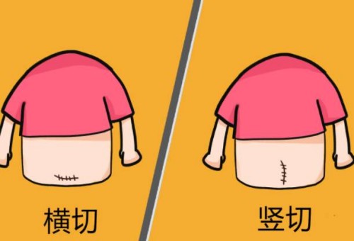 杭州助孕生子：堵奶去医院效果好还是找专业的催乳师好？盲目堵奶对身体并不好